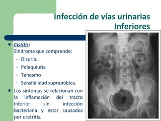 Infección de vías urinarias Inferiores Cistitis :  Síndrome que comprende: Disuria. Polaquiuria Tenesmo Sensibilidad suprapúbica. Los síntomas se relacionan con la inflamación del tracto inferior sin infección bacteriana y estar causados por uretritis. 