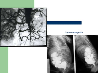 Cistouretrografia 