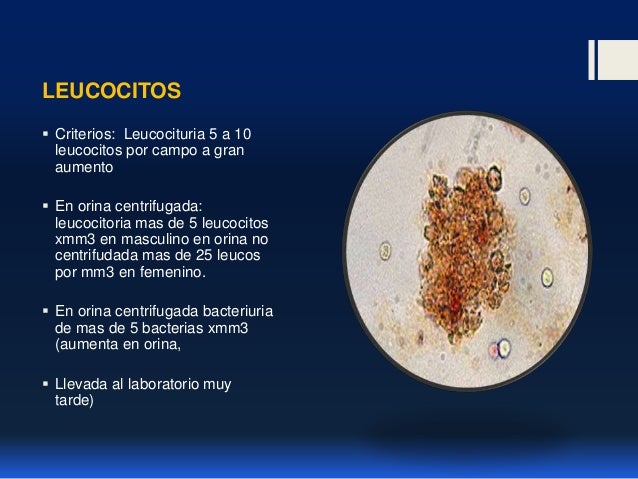 Infeccion de vias urinarias en niños ulises reyes gomez