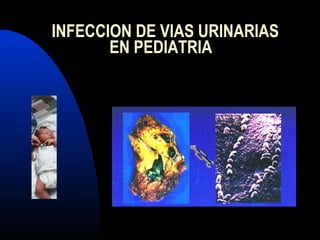 INFECCION DE VIAS URINARIAS
EN PEDIATRIA
 