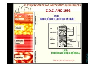 Infect Dis Clin N Am 25 (2011) 135–153
Prof.Dr.LuisdelRioDiez
C.D.C. AÑO 1992
 