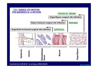 InfectDis Clin N Am 25 (2011) 135-153. / Am Fam Physician.2011;83(5):585-590. Prof.Dr. Luis del Rio Diez
 