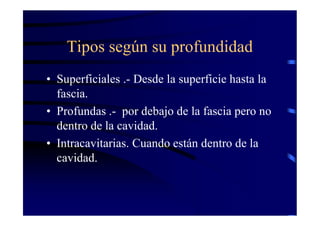Tipos según su profundidad
• Superficiales .- Desde la superficie hasta la
fascia.
• Profundas .- por debajo de la fascia pero no
dentro de la cavidad.
• Intracavitarias. Cuando están dentro de la
cavidad.
 