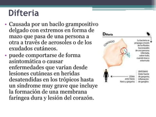 Difteria
• Causada por un bacilo grampositivo
delgado con extremos en forma de
mazo que pasa de una persona a
otra a través de aerosoles o de los
exudados cutáneos.
• puede comportarse de forma
asintomática o causar
enfermedades que varían desde
lesiones cutáneas en heridas
desatendidas en los trópicos hasta
un síndrome muy grave que incluye
la formación de una membrana
faríngea dura y lesión del corazón.
 