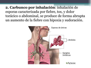 2. Carbunco por inhalación: inhalación de
esporas caracterizada por fiebre, tos, y dolor
torácico o abdominal, se produce de forma abrupta
un aumento de la fiebre con hipoxia y sudoración.
 