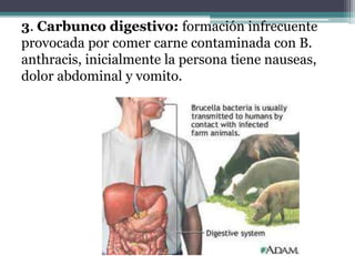 3. Carbunco digestivo: formación infrecuente
provocada por comer carne contaminada con B.
anthracis, inicialmente la persona tiene nauseas,
dolor abdominal y vomito.
 