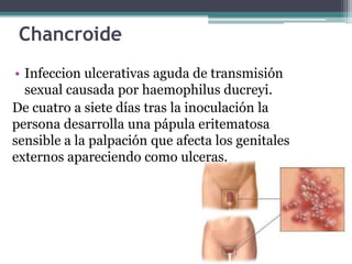 Chancroide
• Infeccion ulcerativas aguda de transmisión
sexual causada por haemophilus ducreyi.
De cuatro a siete días tras la inoculación la
persona desarrolla una pápula eritematosa
sensible a la palpación que afecta los genitales
externos apareciendo como ulceras.
 