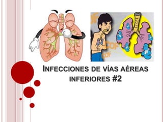 INFECCIONES DE VÍAS AÉREAS
INFERIORES #2
 
