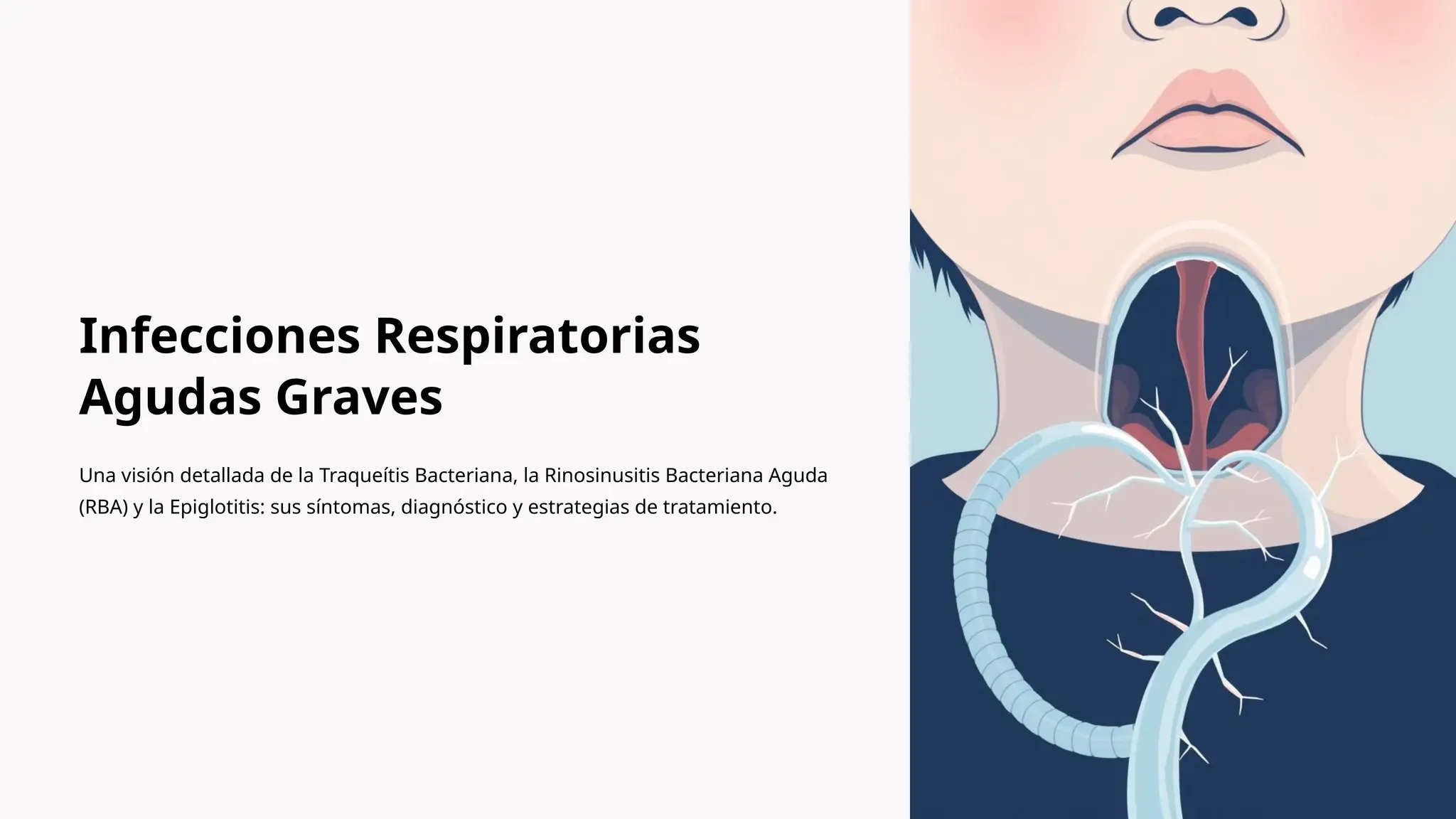 Traqueitis Infecciones-Respiratorias-Agudas-Graves.pptx
