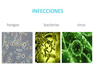 INFECCIONES
hongos bacterias virus
 