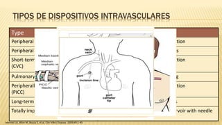 TIPOS DE DISPOSITIVOS INTRAVASCULARES
Type Function
Peripheral venous catheter Short-term intravascular administration
Peripheral arterial catheter Monitor hemodynamics & blood gas
Short-term central venous catheter
(CVC)
Short-term intravascular administration
Pulmonary artery catheter Advanced hemodynamic monitoring
Peripherally inserted central catheter
(PICC)
Short-term intravascular administration
(alternative to a CVC)
Long-term CVC Long-term tunneled vascular access
Totally implantable device Long-term subcutaneous port/reservoir with needle
access
Mermel LA, Allon M, Bouza E, et al. Clin Infect Disease. 2009;49:1-45
 