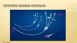 CATETERES VENOSOS CENTRALES
http://microbix.com
 