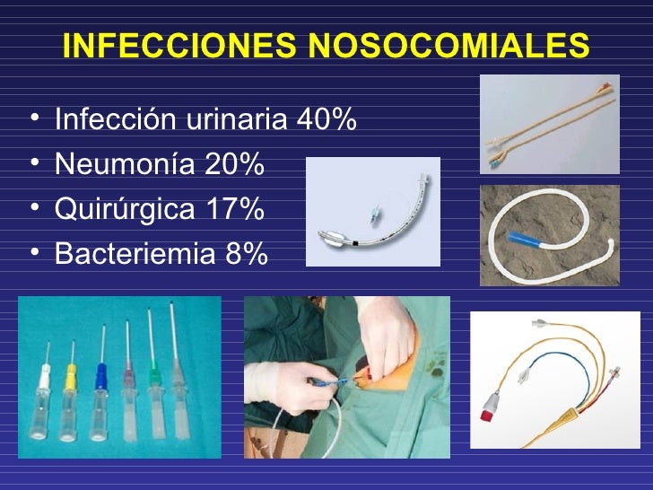Infecciones asociadas a cateteres Infecciones asociadas a cateteres