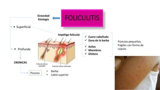 FOLICULITIS
 Superficial
Gravedad
Etiología
Impétigo folicular
 Cuero cabelludo
 Zona de la barba Pústulas pequeñas,
frágiles con forma de
cúpula.
 Axilas
 Miembros
 Glúteos
Psicosis
• Barba
• Labio superior
 Profunda
CRONICAS
 