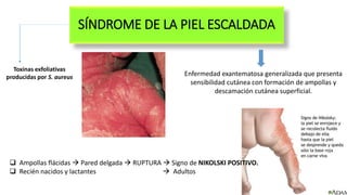 SÍNDROME DE LA PIEL ESCALDADA
Enfermedad exantematosa generalizada que presenta
sensibilidad cutánea con formación de ampollas y
descamación cutánea superficial.
Toxinas exfoliativas
producidas por S. aureus
 Ampollas flácidas  Pared delgada  RUPTURA  Signo de NIKOLSKI POSITIVO.
 Recién nacidos y lactantes  Adultos
 