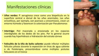 Manifestaciones clínicas
• Uñas verdes: P. aeruginosa crece como una biopelícula en la
superficie ventral o dorsal de las uñas anormales. Las uñas
onicolíticas, por ejemplo, con psoriasis u onicomicosis, crean un
entorno húmedo y favorecen la colonización por Pseudomonas
• Intertrigo: Piel macerada y erosionada en los espacios
interdigitales de los dedos de los pies. Por lo general ocurre
cuando hay hiperhidrosis e hidratación del estrato córneo
• Foliculitis de la tiña de baño caliente: puede infectar múltiples
folículos pilosos durante la exposición en tinas de agua caliente
o de fisioterapia, presentándose como múltiples pústulas
foliculares en el tronco
 