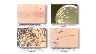 Examen directo de exudado de vesícula.
Coloración de gram: Morfología microscópica
(100 X) INS
Colonias de aspecto rugoso en agar tripticasa
soya INS.
Cultivo de 24 horas en agar sangre.
Coloración de gram: Morfología microscópica
(100 X) INS.
Cultivo de 48 horas en agar tripticasa soya.
Coloración de gram: Observación de esporas
(100 X) INS.
 