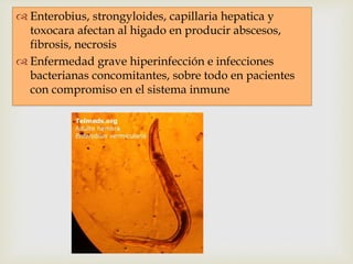 Hidatidosis 
 
 Echinococcus producen los quistes hidatídicos del 
higado 
 Pueden ser grandes de hasta 30 cm 
 Despie...