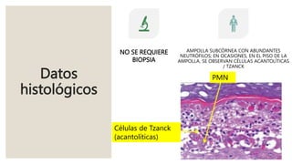 Datos
histológicos
NO SE REQUIERE
BIOPSIA
AMPOLLA SUBCÓRNEA CON ABUNDANTES
NEUTRÓFILOS; EN OCASIONES, EN EL PISO DE LA
AMPOLLA, SE OBSERVAN CÉLULAS ACANTOLÍTICAS
/ TZANCK
PMN
Células de Tzanck
(acantolíticas)
 