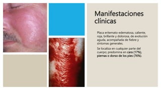 Manifestaciones
clínicas
Placa eritemato-edematosa, caliente,
roja, brillante y dolorosa, de evolución
aguda, acompañada de fiebre y
síntomas generales.
Se localiza en cualquier parte del
cuerpo; predomina en cara (17%),
piernas o dorso de los pies (76%).
 