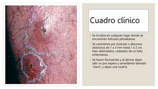 Cuadro clínico
◦ Se localiza en cualquier lugar donde se
encuentren folículos pilosebáceo.
◦ Se caracteriza por pústulas o abscesos
dolorosos de 1 a 3 mm hasta 1 a 2 cm,
bien delimitados, rodeados de un halo
eritematoso.
◦ Se hacen fluctuantes y al abrirse dejan
salir un pus espeso y amarillento llamado
“clavo”, y dejan una cicatriz.
 