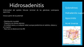 Hidrosadenitis Golondrinos
Hidradenitis supura
Apocrinitis
Acné inversa
Enfermedad del epitelio folicular terminal de las glándulas sudoríparas
apocrinas.
Inicia a partir de la pubertad
- Distribución mundial
- Trópicos y en climas caluroso
- En ambos sexos y a cualquier edad, aunque predomina en adultos, obesos y
en mujeres
- Rara vez se observa en los RN
 