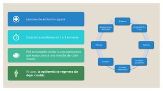 Lesiones de evolución aguda
Curación espontánea en 2 a 3 semanas
Piel erosionada similar a una quemadura
que evoluciona a una mancha de color
rosado
Al curar, la epidermis se regenera sin
dejar cicatriz
Eritema
Ampolla 0.5 a
2 cm
Pústula
Exudado
purulento
Costras
melicéricas
Erosión
Mácula
Regeneración
de la piel
 