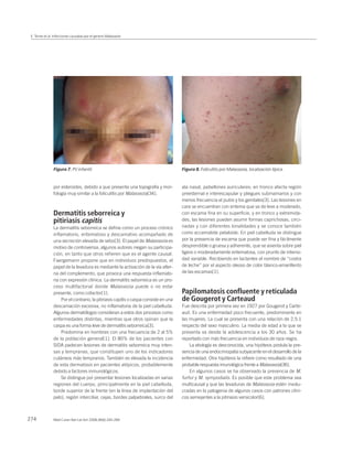 Sebo Capities Infecciones causadas por el genero malassezia | PDF