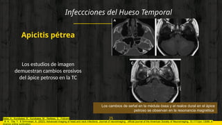 INFECCIONES CABEZA Y CUELLO CIRUGIA ORAL Y MAXILOFACIAL .pptx