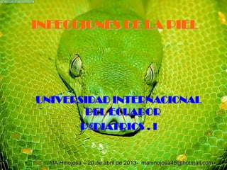 INFECCIONES DE LA PIEL
UNIVERSIDAD INTERNACIONAL
DEL ECUADOR
PӔDIATRICS . I
MA Hinojosa – 20 de abril de 2013- mahinojosa45@hotmail.com
 