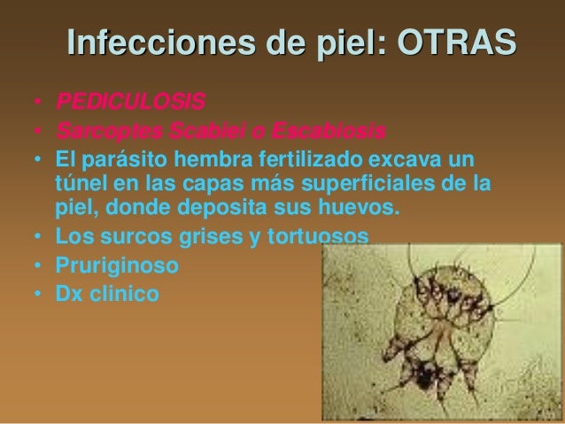Las medicinas para el tratamiento de la psoriasis de las uñas