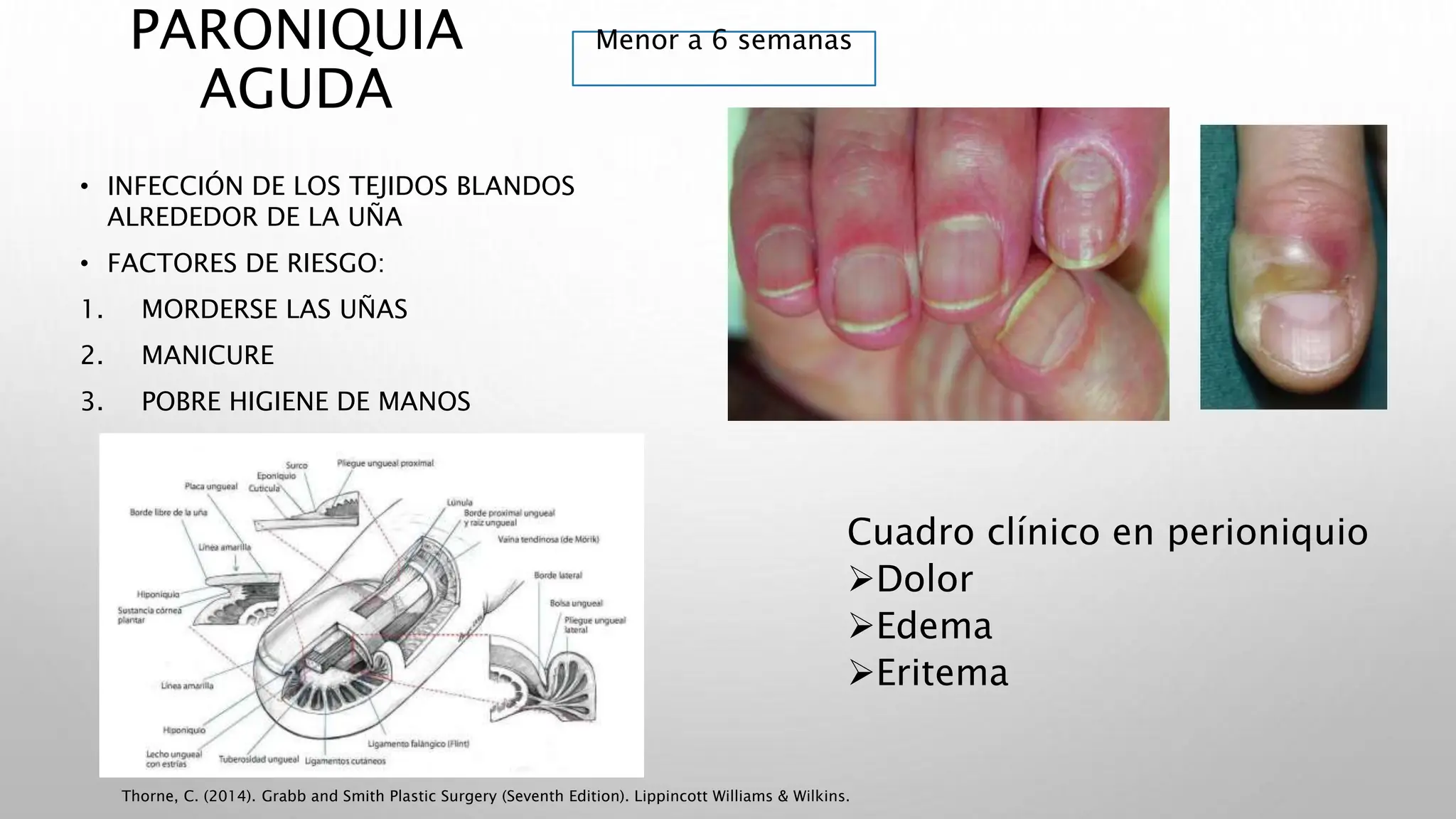 Infecciones de la punta de los dedos.pptx
