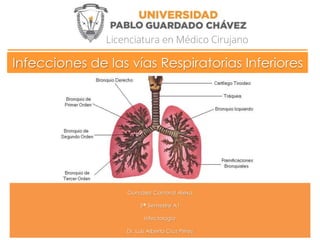 Infecciones de las vías Respiratorias Inferiores
González Cantoral Alexa
5° Semestre A1
Infectología
Dr. Luis Alberto Cruz Pérez
 