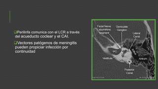 Perilinfa comunica con el LCR a través
del acueducto coclear y el CAI.

Vectores patógenos de meningitis
pueden propiciar infección por
continuidad

 