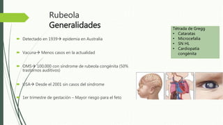 Laberintitis Infecciones del laberinto, Laberintitis | PPTX