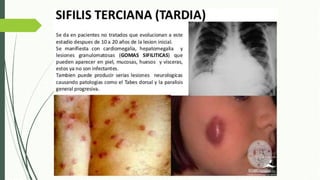 Laberintitis Infecciones del laberinto, Laberintitis | PPTX