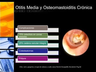 Otitis Media y Osteomastoiditis Crónica
Complicaciones
75% osteólisis en zonas
aisladas
25% cadena osicular integra
Colesteatomas
Pólipos
Oído, naríz, garganta y cirugía de cabeza y cuello Jesús Ramón Escajadillo 4ta edición Pag 82
 