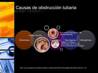 Causas de obstrucción tubaria
Infecciosas Alérgicas Traumáticas Neurógenas Iatrogénicas
Oído, naríz, garganta y cirugía de cabeza y cuello Jesús Ramón Escajadillo 4ta edición Pag 72 y 73
Paladar Hendido
Debido al colapso
persistente de la TE por
poca elasticidad del cartílago
Frecuencia elevada de OM
desde lactantes
 