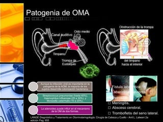 Patogenia de OMA
Aunque la infección viral es importante en la
patogenia de la AOM, la mayoría de los
sujetos desarrolla colonización bacteriana.
Streptococcus pneumoniae (hasta 40%),
Haemophilus influenzae (25 a 30%), y
Moraxella catarrhalis (10 a 20%).
La adenoides puede influir en el mecanismo
de la OM de dos formas.
□ Absceso subperióstico
□ Parálisis Facial.
□ Fístula laberíntica
□ Laberintitis purulenta.
□ Petrositis.
□ Meningitis.
□ Absceso cerebral.
□ Trombofletis del seno lateral.
LANGE Diagnóstico y Tratamiento en Otorrinolaringología. Cirugía de Cabeza y Cuello - Anil L. Lalwani 2a
edición Pag. 655
 