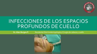 INFECCIONES DE LOS ESPACIOS
PROFUNDOS DE CUELLO
Dr. Alan Burgos P. Residente Otorrinolaringología yCirugía de cabeza y cuello
 