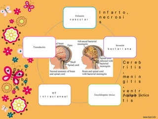 I n f a r t o ,
                                                Oclusión
                                            v a s c u l a r
                                                                  n e c r o s i
                                                                  s




                                                                                  Invasión
            Trasudación
                                                                           b a c t e r i a n a




                                                                                       Ce r e     b
                                                                                       r i t i    s
De r    r
                                                                                       ,
a me    s
                                                                                       me n i     n
s u b   d
                                                                                       g i t i    s
u r a   l
                                                                                       ,
e s
                            HT
                                                                                       v e n t    r
                  i n t r a c r a n e a l
                                                              Encefalopatía tóxica     Acidosis
                                                                                       i c u l    láctica
                                                                                                  i
                                                                                       t i s
 