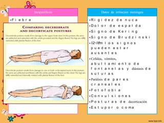 Inespecíficos                    Datos de irritación meníngea

•F i e b r e                             •R i g i d e z d e n u c a
• Síntomas V R S                         •D o l o r      d e e s p a l d a
•A n o r e x i a                         •S i g n o d e K e r i n g
•Mi a l g i a s                          •S i g n o d e B r u d z i n s k i
•A t r a l g i a s                       • 12-18m l o s s i g n o s
•T a q u i c a r d i a                     p u e d e n e s t a r
• Hipotensión                              a u s e n t e s

• Signos cutáneos (petequias, púrpura,   • Cefalea,   vómitos,
  erupción                                 a b u l    t a mi e n t o d e
  ma c u l o e r i t e ma t o s a )        f o n t    a n e l a s y diástasis d e
                                           s u t u    r a s
                                         • Parálisis d e p a r e s
                                           c r a n e a l e s
                                         •F o t o f o b i a
                                         •C o n v u l s i o n e s
                                         • P o s t u r a s d e decorticación
                                         •E s t u p o r      o c o ma
 