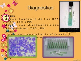 Diagnostico
 Clínica
 Ba s c i l o s c o p i a d e l o s             B A A R (z i e h l -
  N e e l s e n ) 95%
 C u l t i v o s (L o w e n s t e i n           -J e n s e n ) 50 %
 Radiografía de tórax , T A C , R M
 Estudios                                                    serológicos
  (c o n t r a i n m u n o e l e c t r o         f o r e s i s )
 Estudios moleculares (detección del material   genético)
 