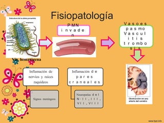 Fisiopatología
                                P MN                    Va s o e s
                             i n v a d e                 p a s mo
                                  n                     Va s c u l
                                                          i t i s
                                                        t r o mb o
                                                           s i s

Vía hematógena

       Inflamación de             Inflamación d e
       nervios y raíces              p a r e s
          raquídeos             c r a n e a l e s


                                    Neuropatías d e l
          Signos meníngeos          N. I I , I I I ,
                                    VI I , VI I I
 