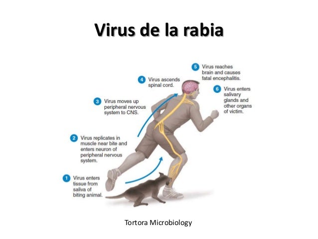 Infecciones del Sistema Nervioso Central