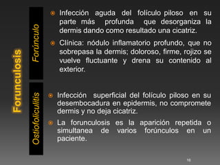    Infección aguda del folículo piloso en su
                       parte más profunda que desorganiza la
Forúnculo
                       dermis dando como resultado una cicatriz.
                      Clínica: nódulo inﬂamatorio profundo, que no
                       sobrepasa la dermis; doloroso, ﬁrme, rojizo se
                       vuelve ﬂuctuante y drena su contenido al
                       exterior.


                       Infección superﬁcial del folículo piloso en su
Ostiofoliculitis




                   
                       desembocadura en epidermis, no compromete
                       dermis y no deja cicatriz.
                      La forunculosis es la aparición repetida o
                       simultanea de varios forúnculos en un
                       paciente.

                                                             16
 