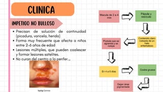Precisan de solución de continuidad
(picadura, varicela, herida)
Forma muy frecuente que afecta a niños
entre 2-6 años de edad
Lesiones múltiples, que pueden coalescer
y formar lesiones satelites.
No curan del centro a la periferia
CLINICA
iMPETIGO NO BULLOSO
 