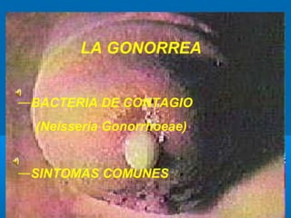 LA GONORREA


―BACTERIA DE CONTAGIO
  (Neisseria Gonorrhoeae)


―SINTOMAS COMUNES
 