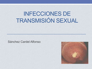 INFECCIONES DE
TRANSMISIÓN SEXUAL
Sánchez Cardel Alfonso
 
