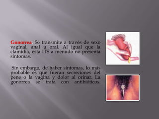Gonorrea: Se transmite a través de sexo
vaginal, anal u oral. Al igual que la
clamidia, esta ITS a menudo no presenta
síntomas.

Sin embargo, de haber síntomas, lo más
probable es que fueran secreciones del
pene o la vagina y dolor al orinar. La
gonorrea se trata con antibióticos.
 